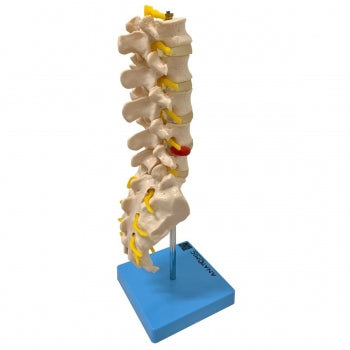 Coluna Vertebral Lombar Anatomic Tgd 0145 B 1107 1