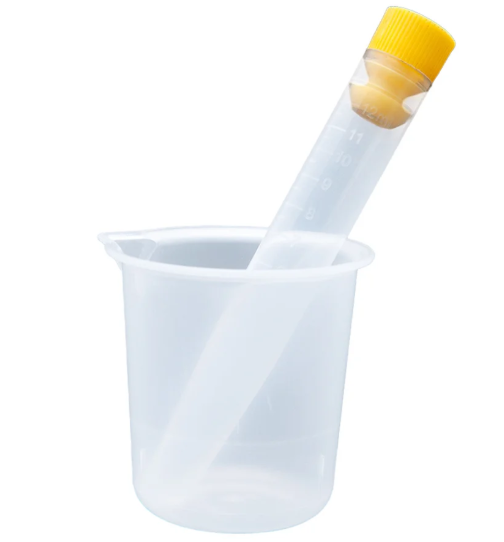 Kit Urina Tubo amarelo 12ml com Becker